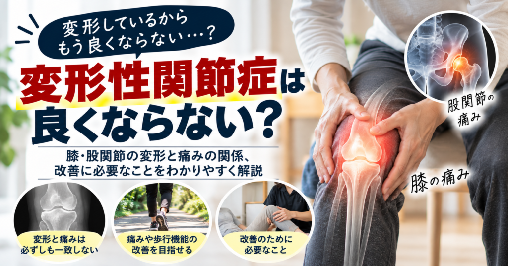 変形性関節症は良くならない？膝・股関節の変形と痛みの関係、改善に必要なこと
